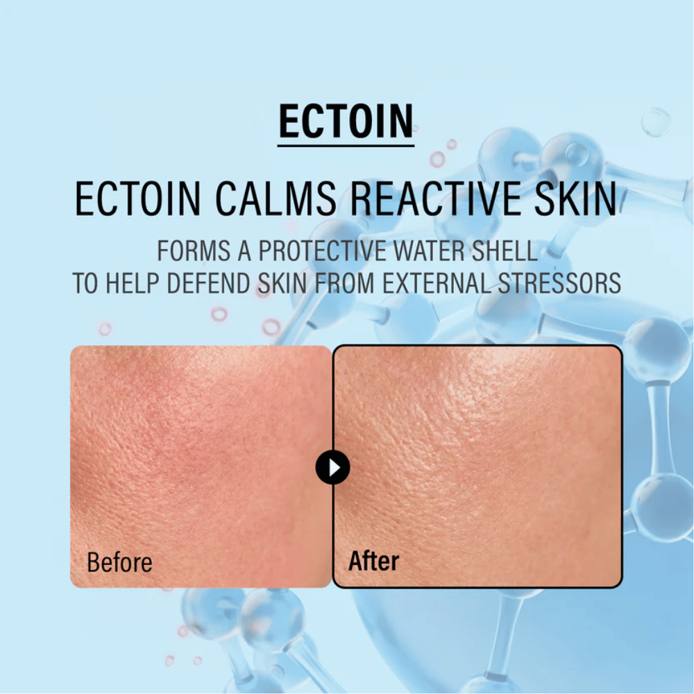 EPII Double Up Cream avec ectoïne qui apaise la peau sensible, protège contre les agressions extérieures et renforce la barrière naturelle de la peau.