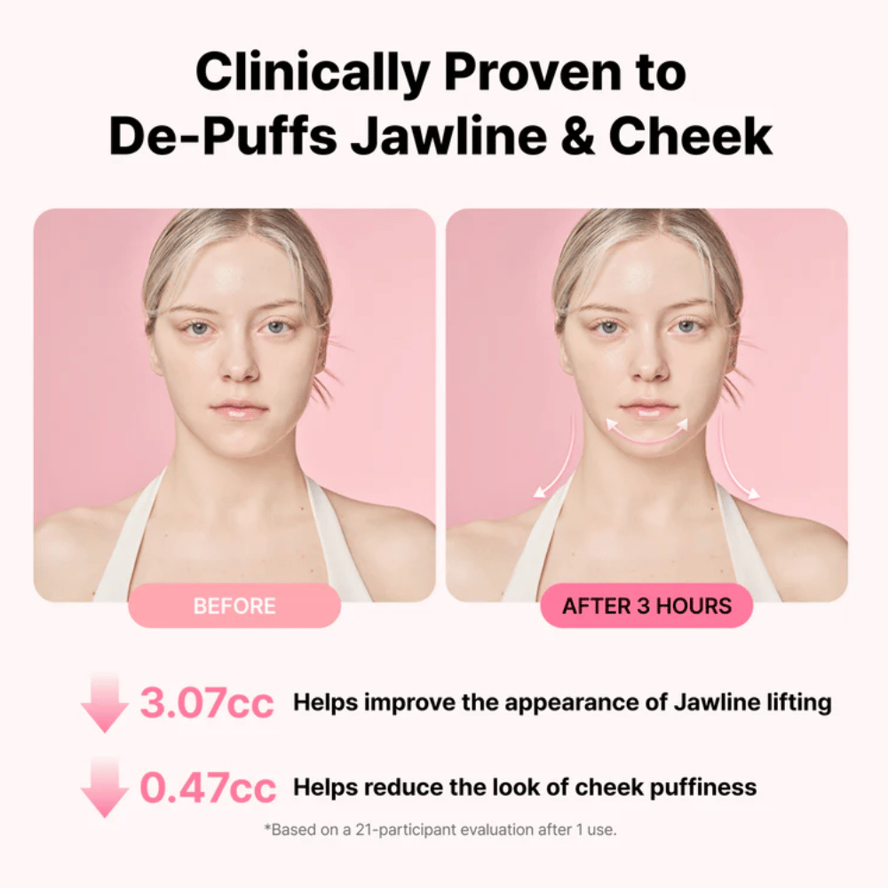 Image avant/après illustrant l’amélioration de l’apparence de la mâchoire et la réduction du gonflement après l’utilisation de RETURNITY Ear Therapy Acupressure Patch pendant trois heures.