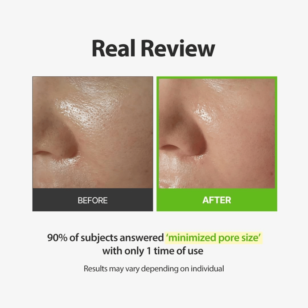SUNGBOON EDITOR Green Tomato Pore Peeling Jumbo Pad – image avant/après mettant l’accent sur les pores visibles