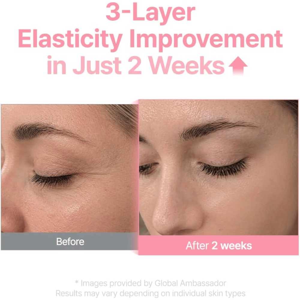 Image avant/après pour Purito Multi PDRN Collagen EGF Serum montrant une amélioration de l’élasticité de la peau après deux semaines.