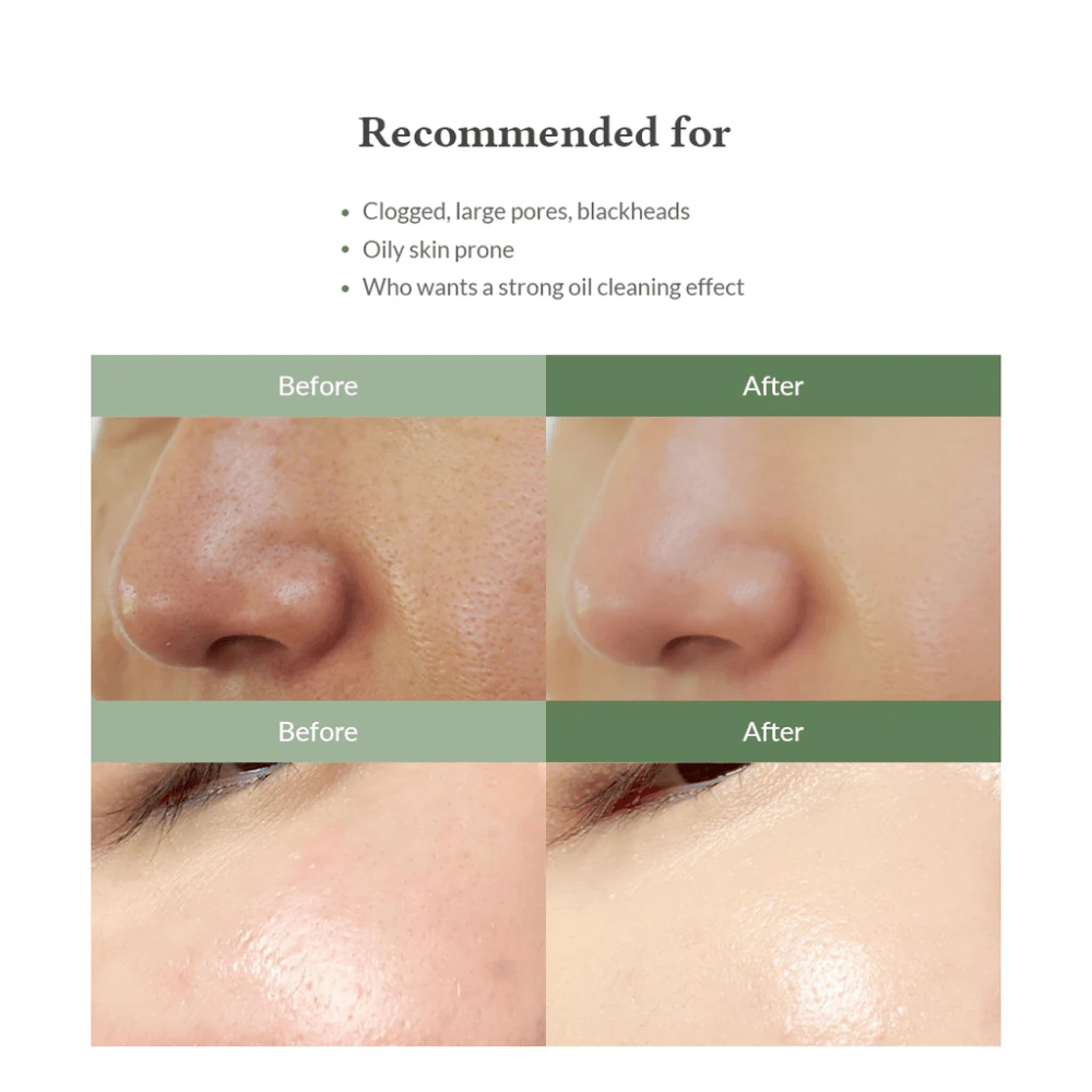 Dr. Althea Premium Quick Step Sebum Cleanser – nettoyant pour le visage qui aide à réduire les points noirs, à nettoyer les pores en profondeur et à donner une texture de peau plus uniforme.