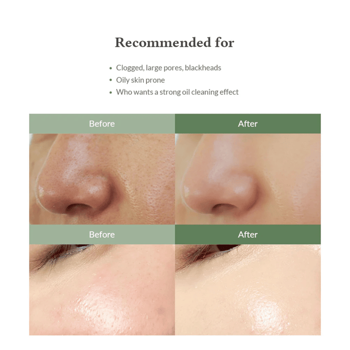 Dr. Althea Premium Quick Step Sebum Cleanser – nettoyant pour le visage qui aide à réduire les points noirs, à nettoyer les pores en profondeur et à donner une texture de peau plus uniforme.