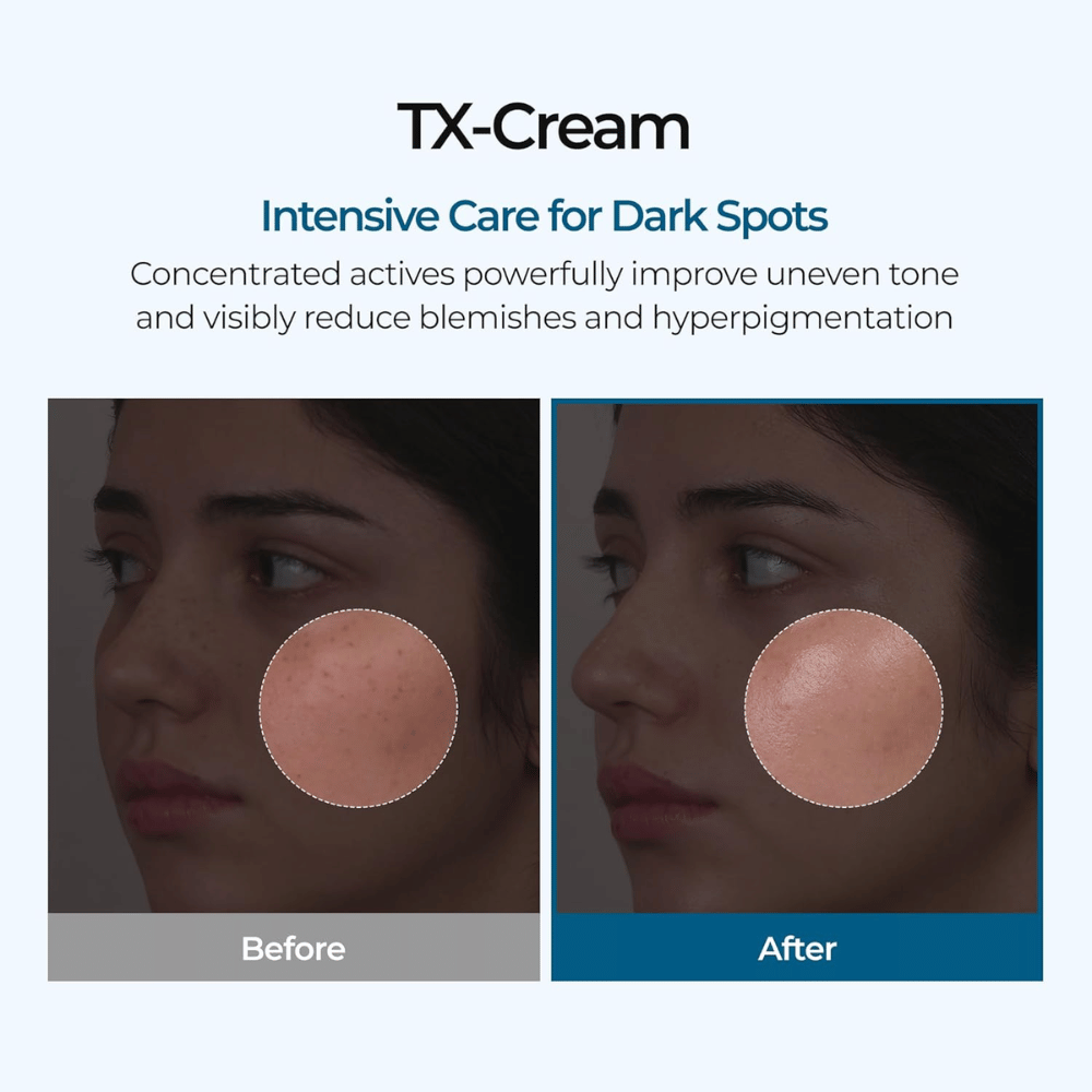 Résultats avant et après avec TX Cream qui réduit les taches brunes et le teint irrégulier pour une peau visiblement plus claire et plus uniforme